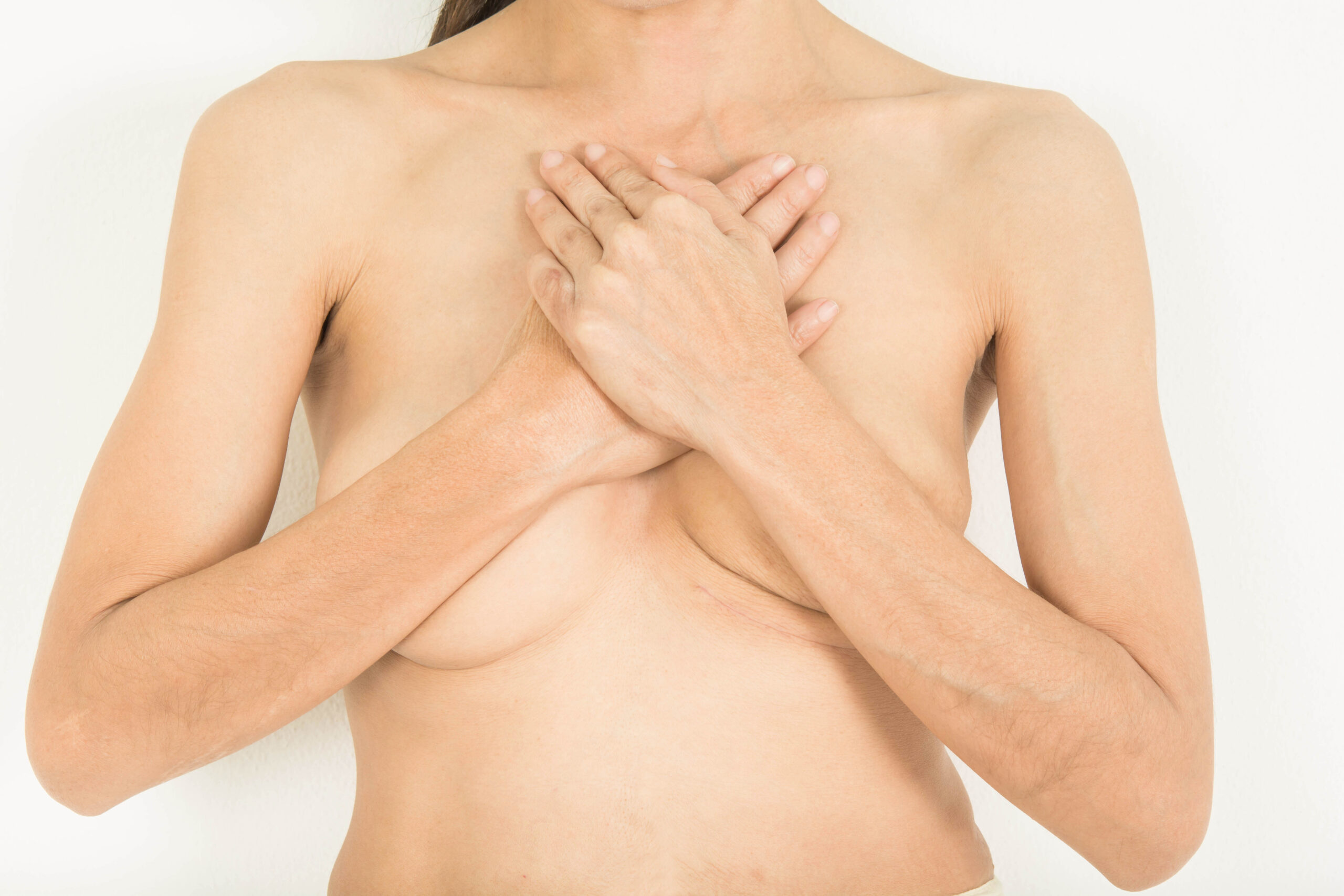 breast-reconstruction